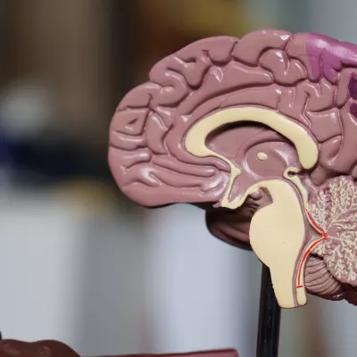 medical model of a brain