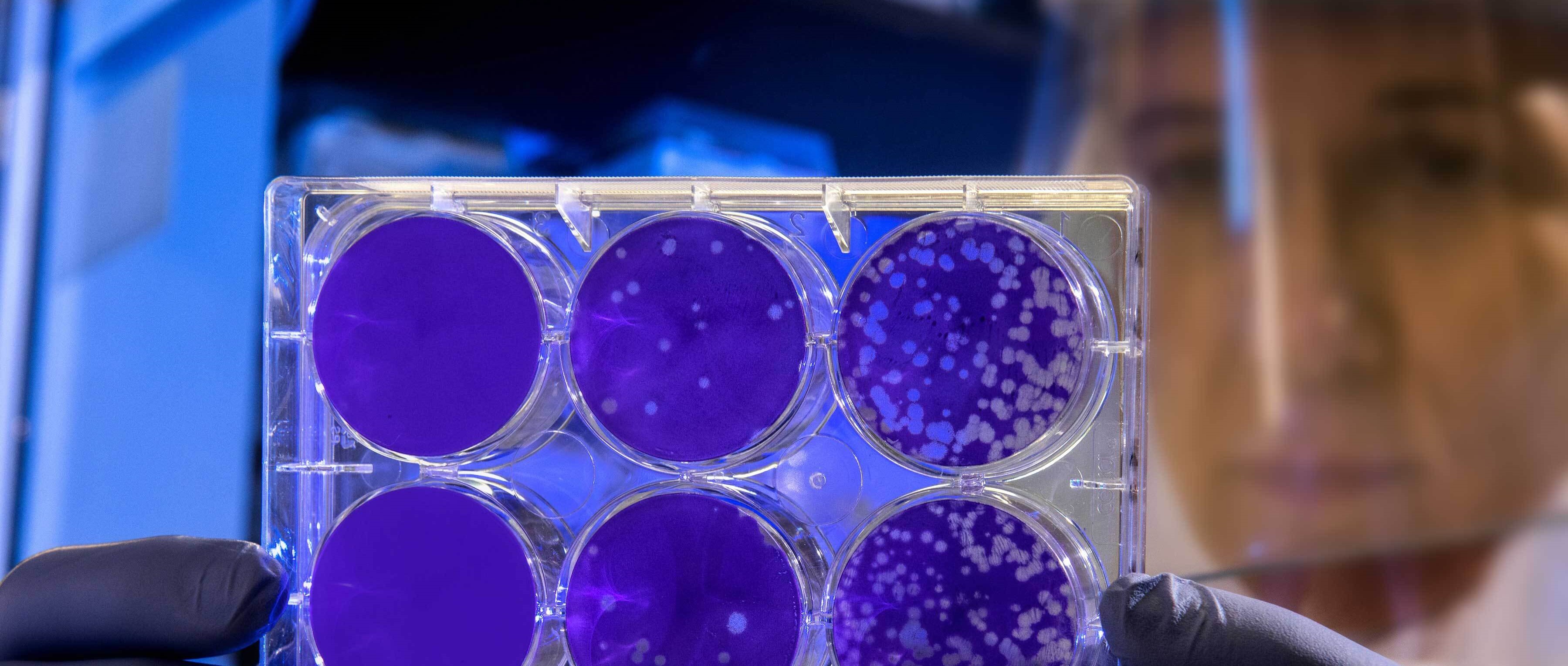 scientist examines a petri dish