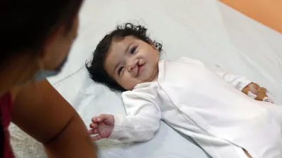 baby with cleft lip smiles up at mother 