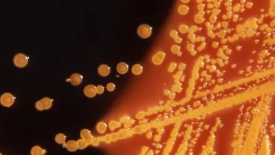  colonies of Escherichia coli bacteria, grown on a Hektoen enteric (HE) agar plate medium