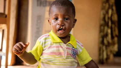 young girl in Nigeria with cleft lip